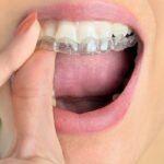 隱適美兼具美觀與舒適，深受成人與青少年歡迎