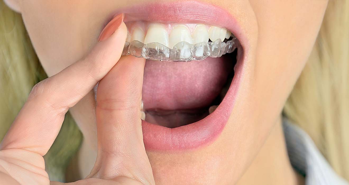 隱適美兼具美觀與舒適，深受成人與青少年歡迎