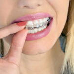 隱適美推薦必看！想做隱適美卻不知怎麼挑醫師？